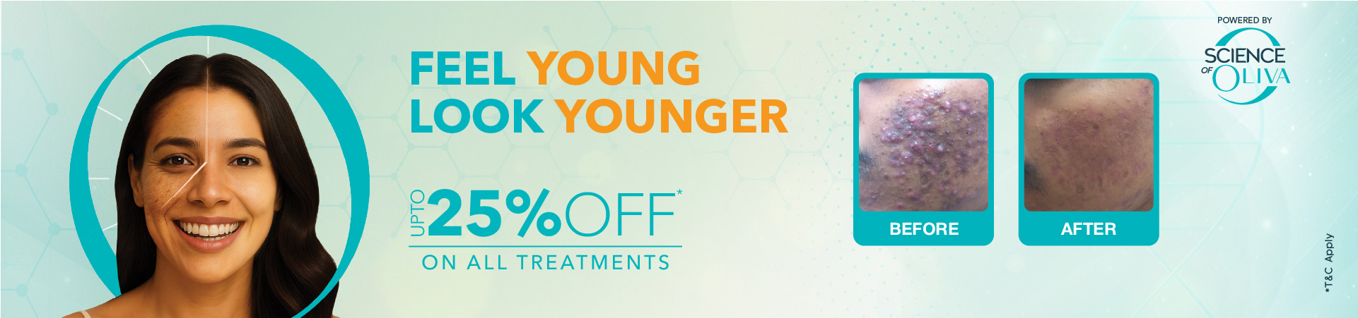 Acne/Pimple Treatment Banner