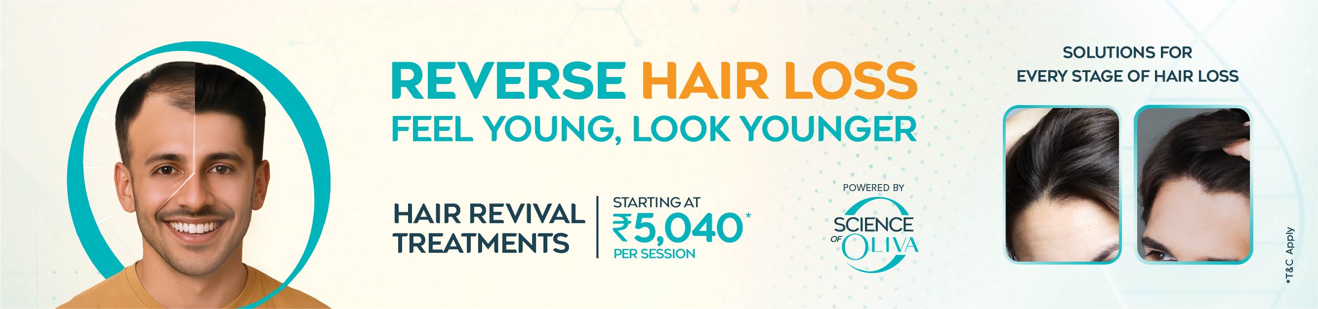 Hair Loss