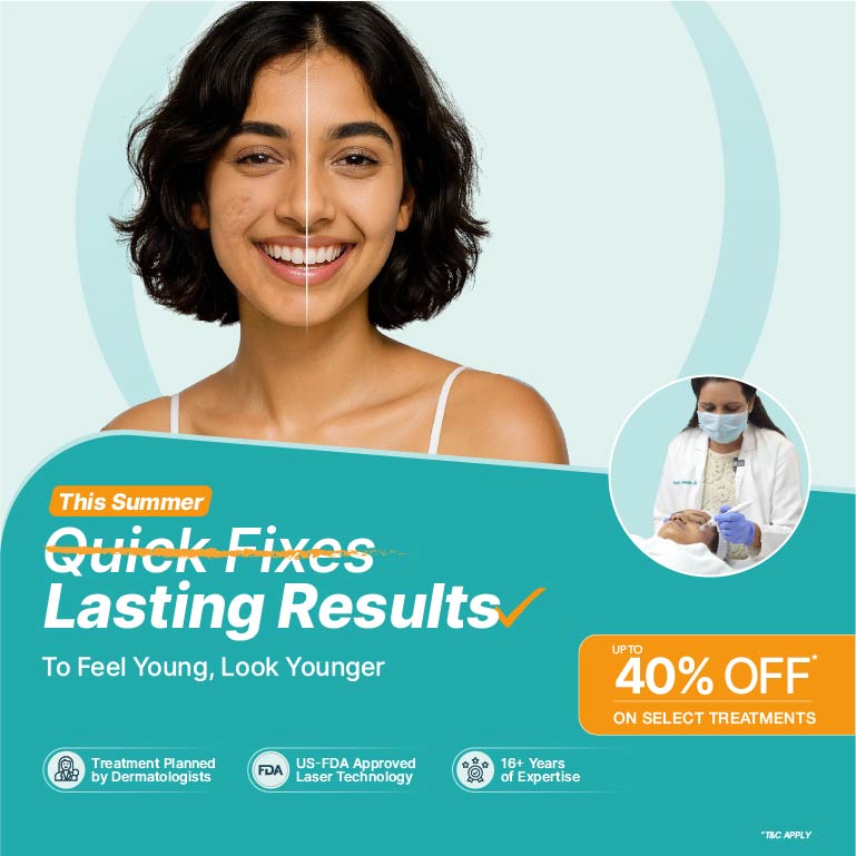 Acne/Pimple Treatment Banner