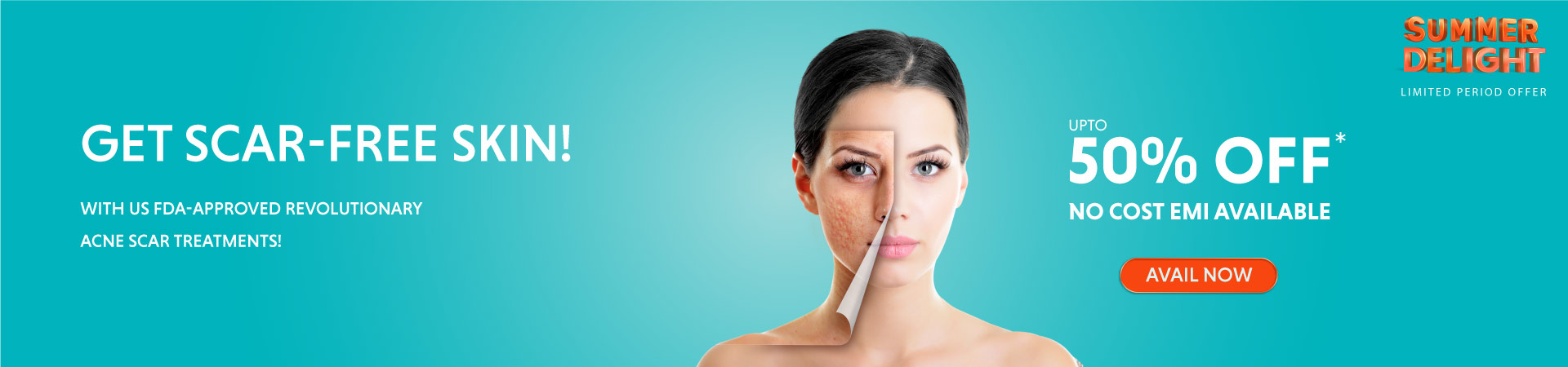 Pimple/Acne Scar Treatment Banner