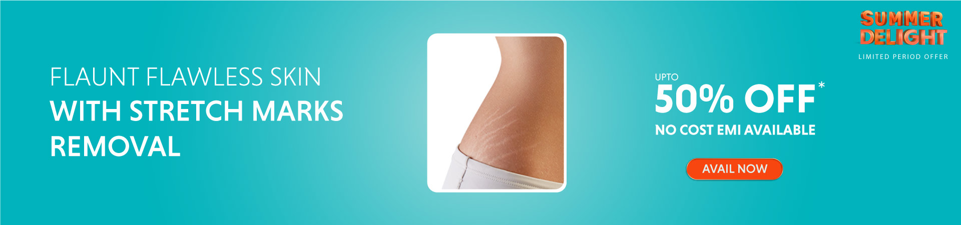 Stretch Marks Treatment Banner