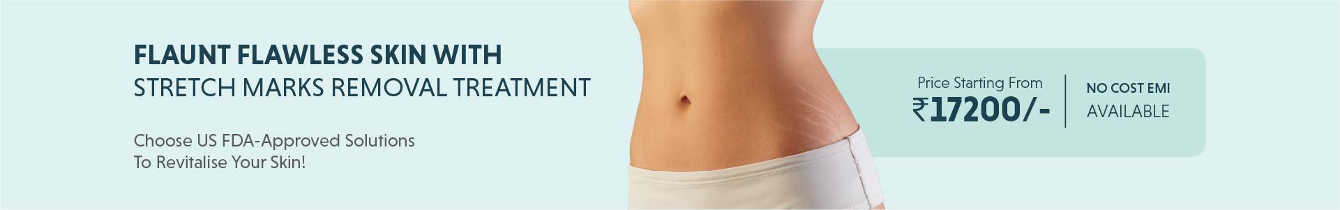 Stretch Mark Treatment