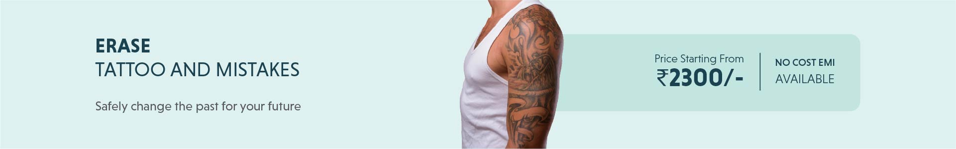 Tattoo Removal