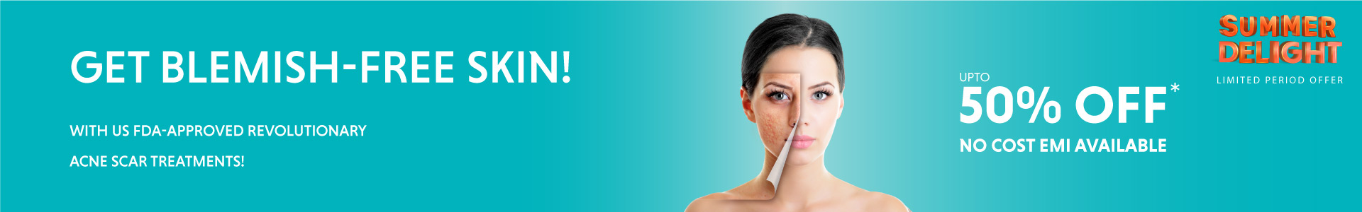 acne scar treatment banner