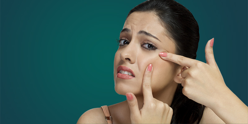 how to cure pimple