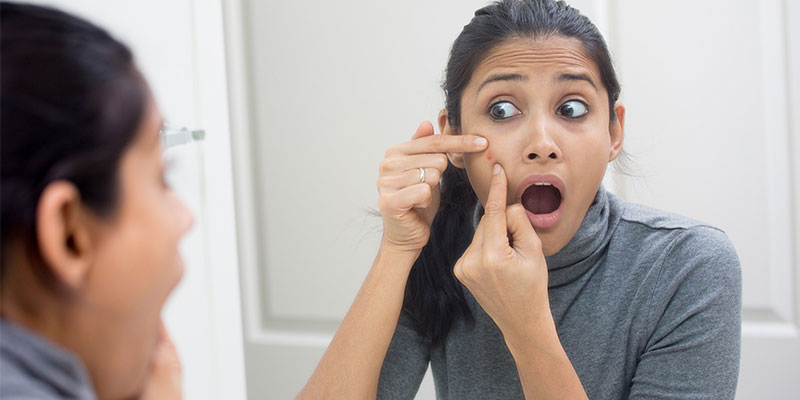powerful home remedies for acne