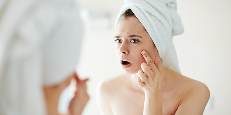 Dark spots on the skin: Causes, treatments, and remedies