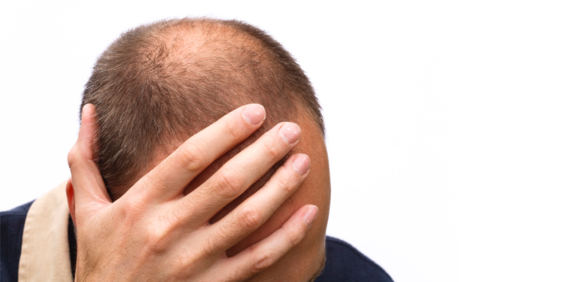 How To Grow Hair On Bald Spot - Treatments And Prevention Tips