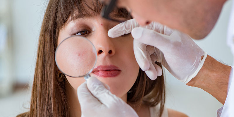 difference between acne and pimples