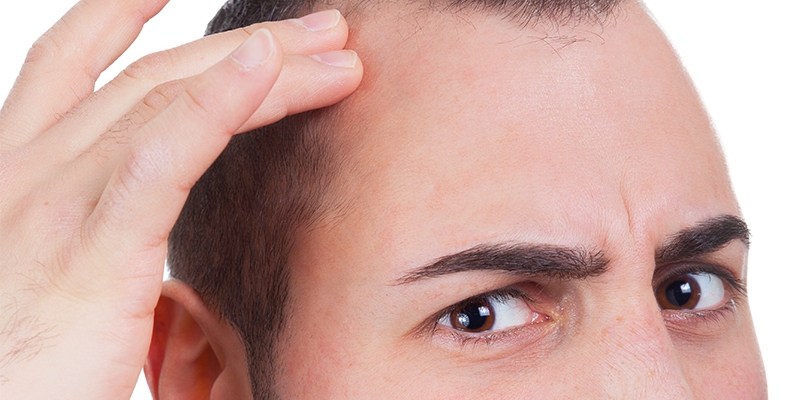 Temple Hair Loss: Causes And Treatment Options (For Males & Females)