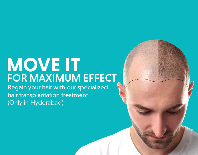 Hair Transplant in Hyderabad - Get Best Treatment at Advanced Clinic