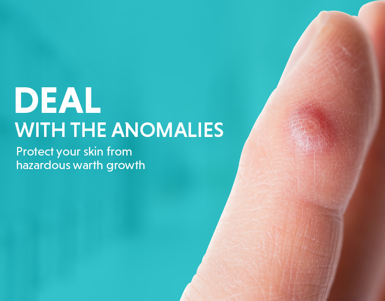 warts removal treatment