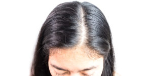 How To Increase Hair Density And Hair Volume Treatments And Tips