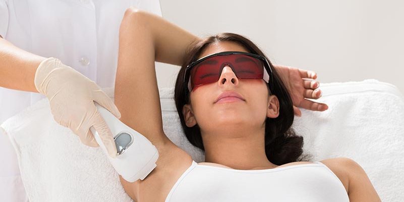 laser hair removal cost in chennai