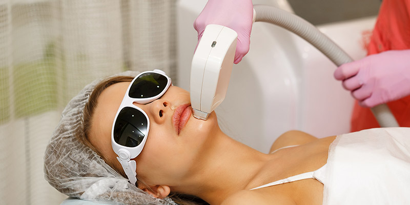laser hair removal cost in kochi
