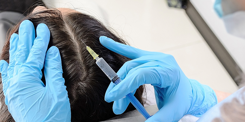 PRP Hair Loss Treatment in Pune - Cost, Benefits & Results