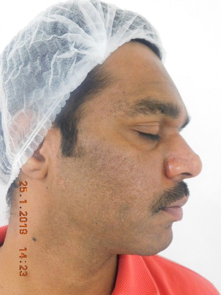 Suman Kumar After