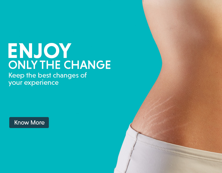 Stretch Mark Treatment in Hyderabad - Laser Stretch Mark Removal Clinics