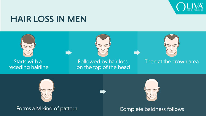 hair loss in men