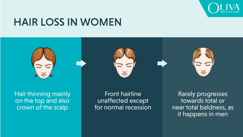 hair loss in women