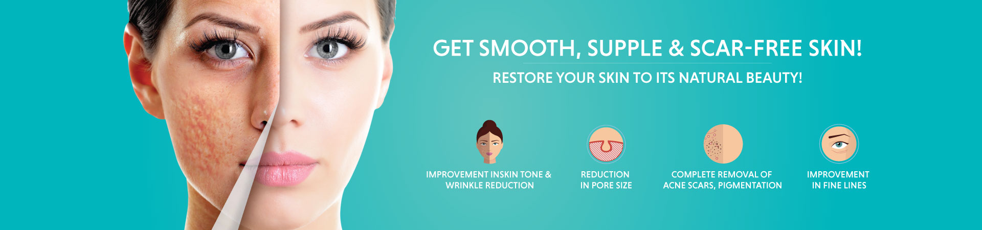 vizag skin treatment Recommended Scars: Acne And Care Causes, Classification,