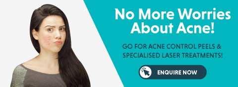 Book An Appointment For Acne Treatment