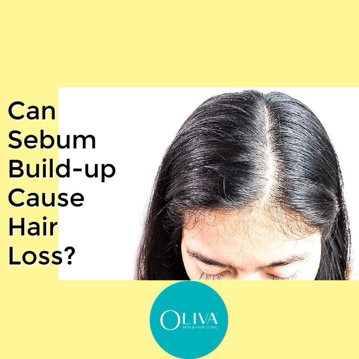How To Remove Excess Sebum From Scalp: Causes And Tips