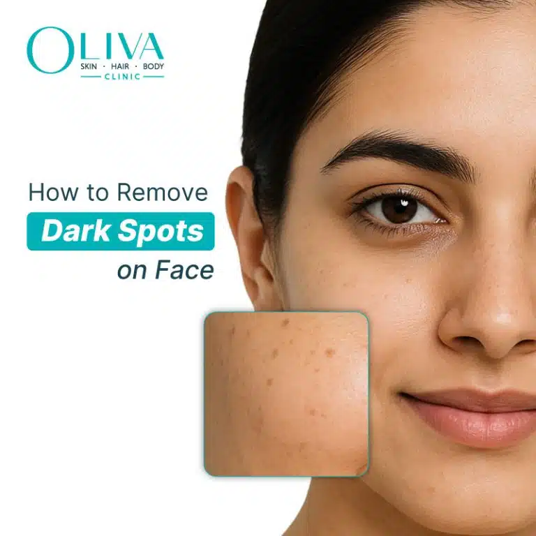 Black Dark Spots On Face