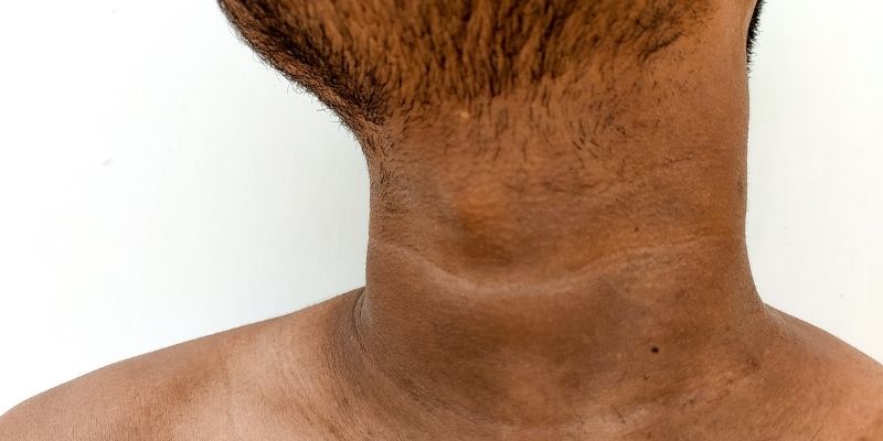 black neck