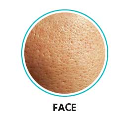 open pores on face