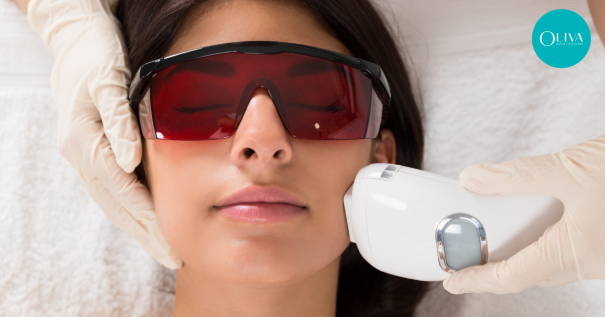 Laser Facial Hair Removal For Women