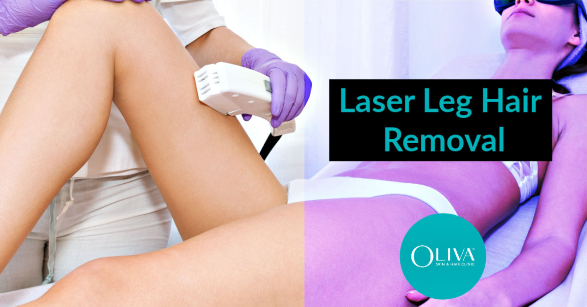 Laser Hair Removal For Legs