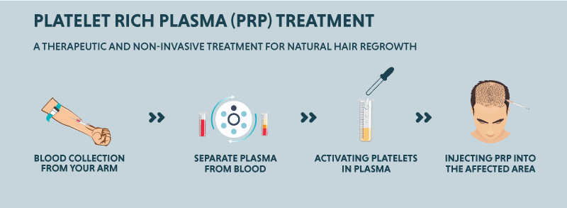 PRP Hair Treatment Procedure