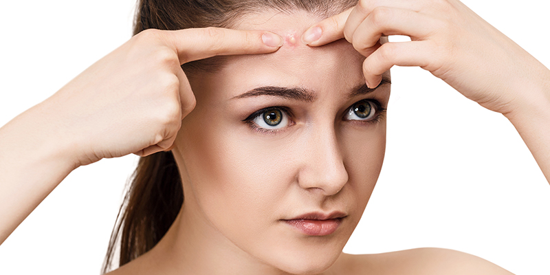Top 10 Acne Myths