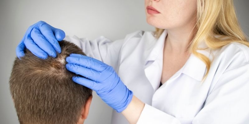 Alopecia treated by dermatologists
