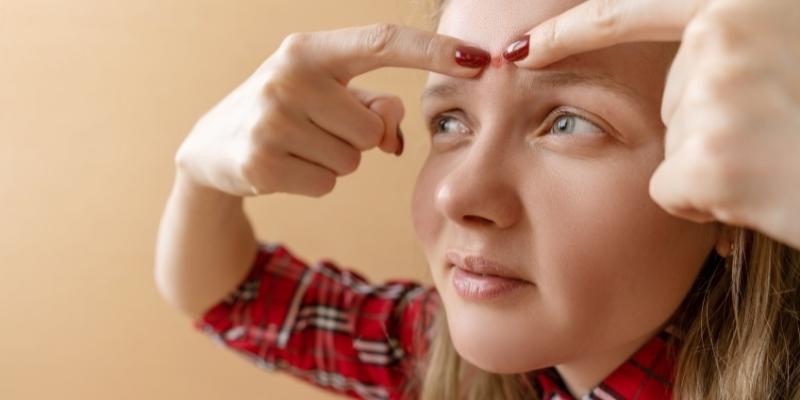 forehead acne