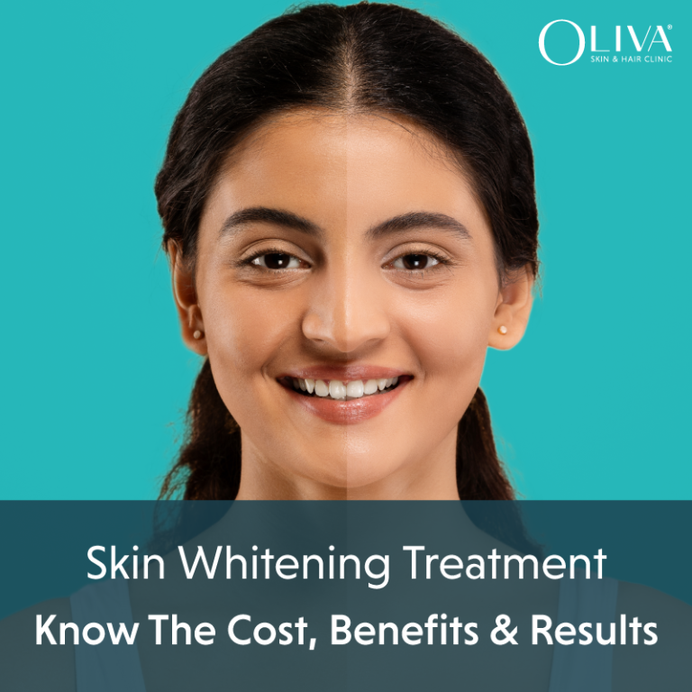 Skin Whitening Treatment