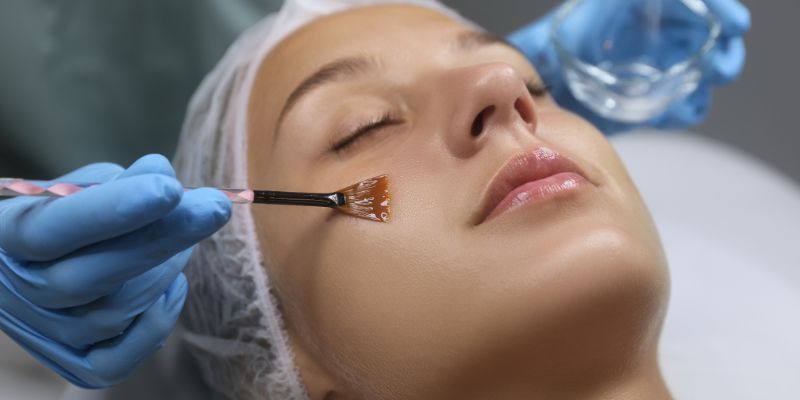 Chemical Peel Treatment: Benefits, Procedure, Before And After Results