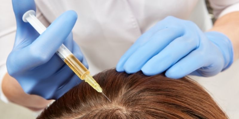 Here Are The Top Myths And Facts About PRP Hair Loss Treatment