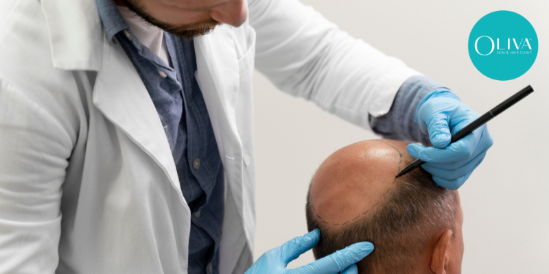 Cost Of Hair Transplant Treatment