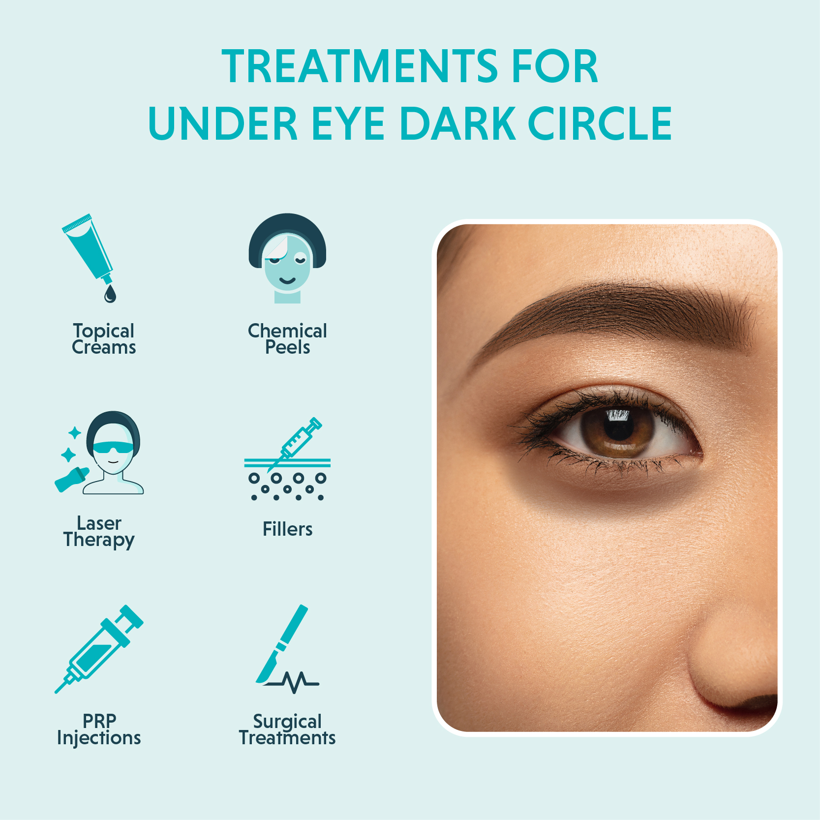 Dark-Circle-Treatment.jpg