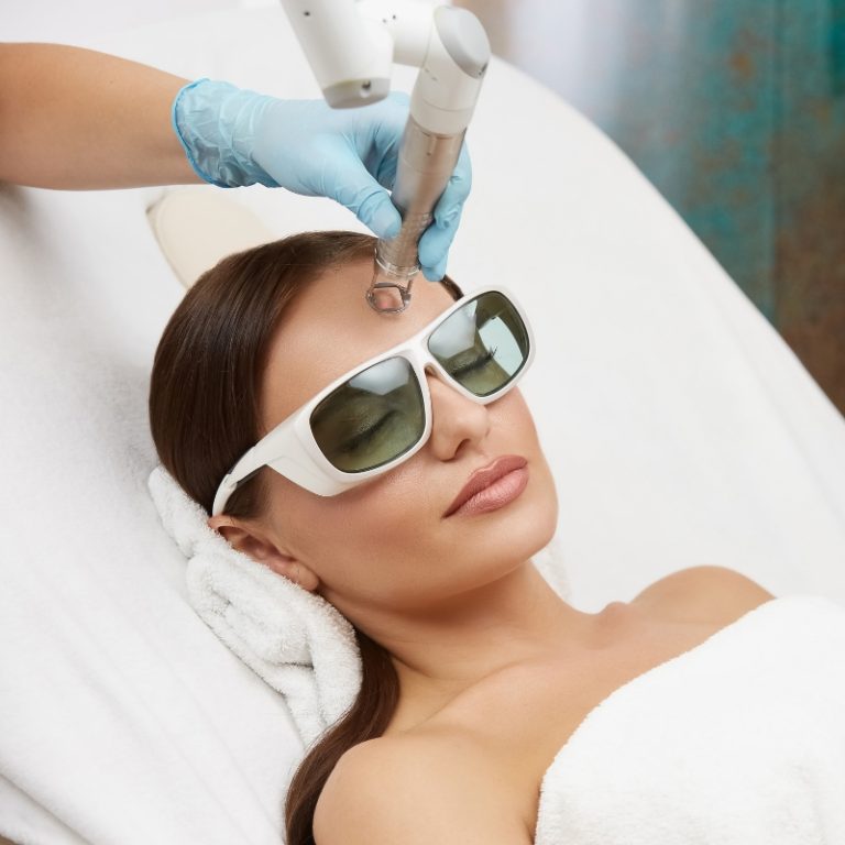 laser skin resurfacing in hyderabad