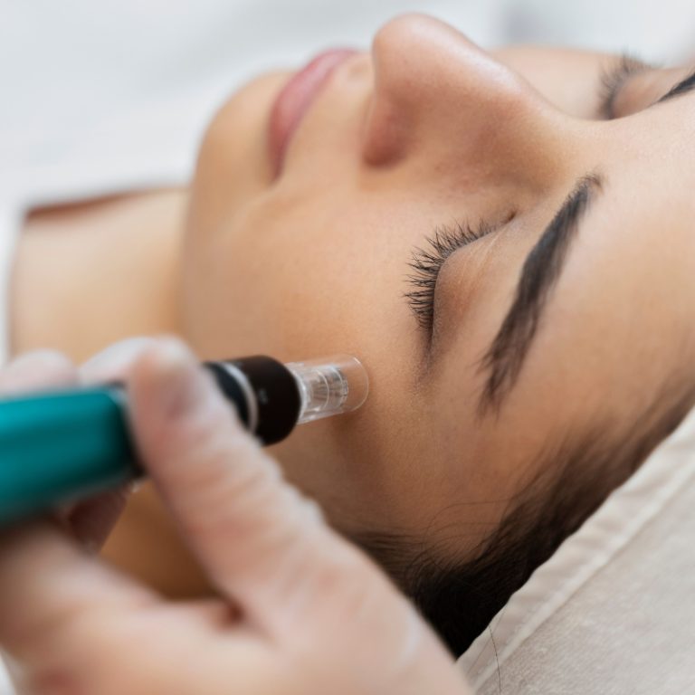 mnrf treatment in bangalore
