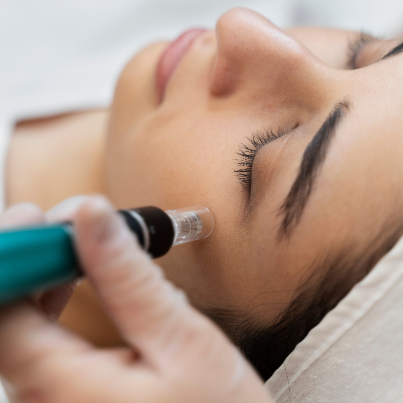 mnrf treatment in bangalore