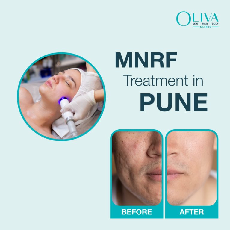 mnrf treatment in pune