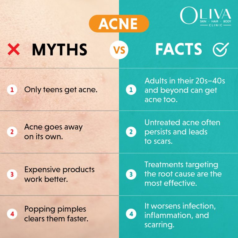 acne myths and facts