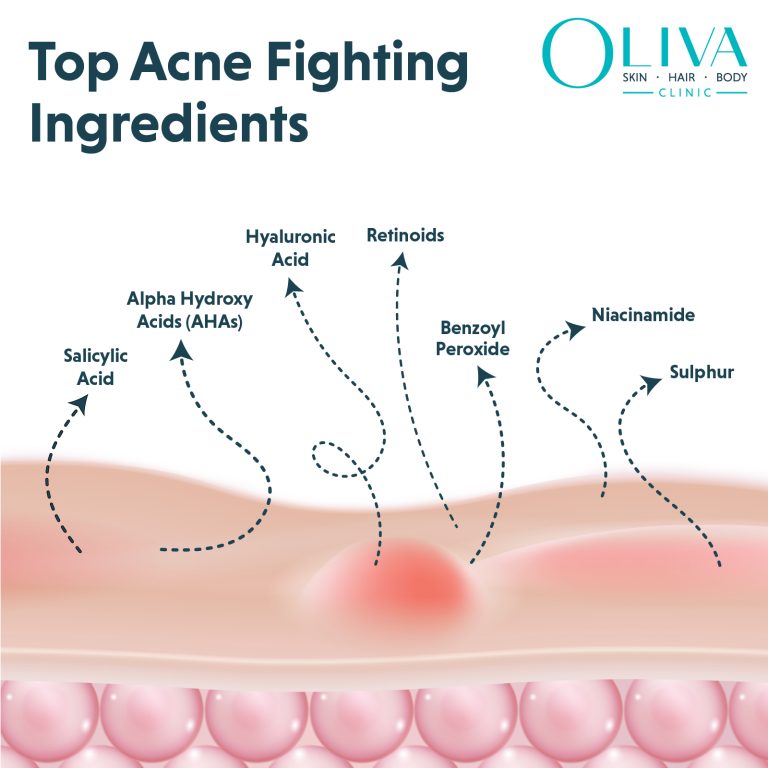 ingredients for acne