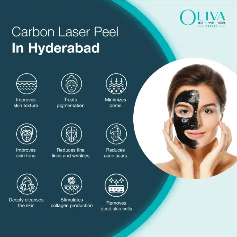 carbon laser treatment in hyderabad