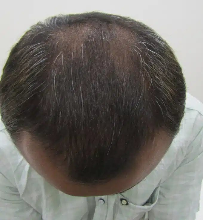 After