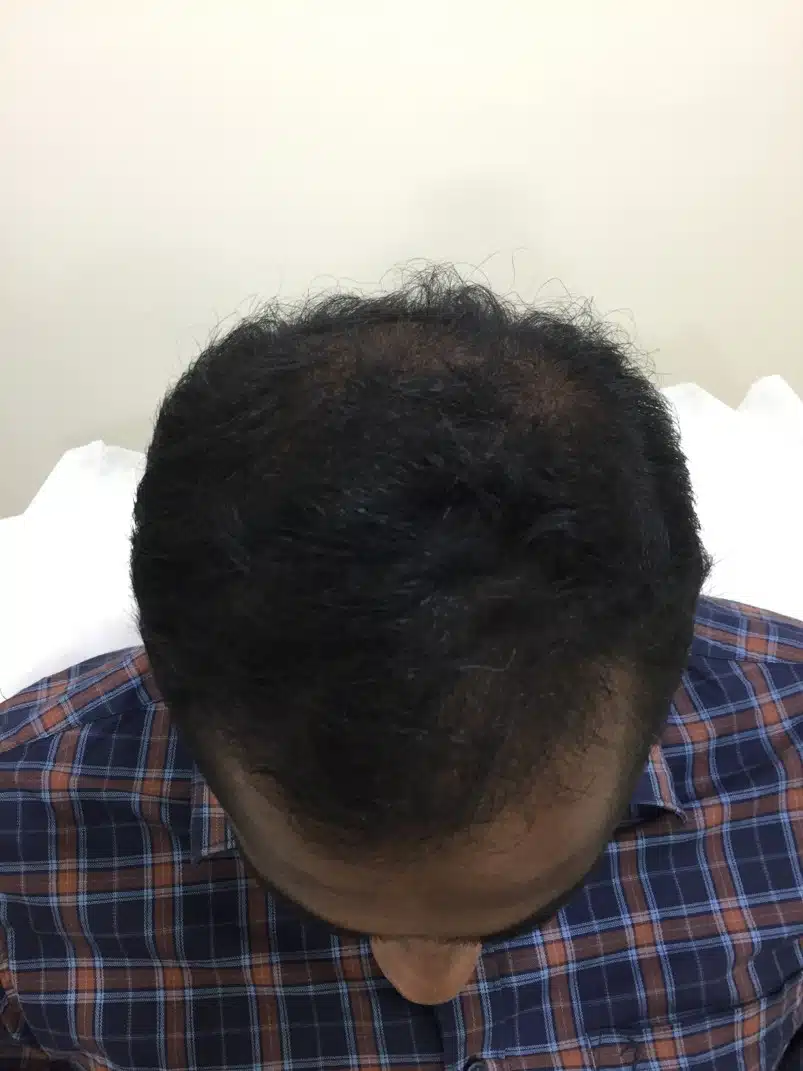 After